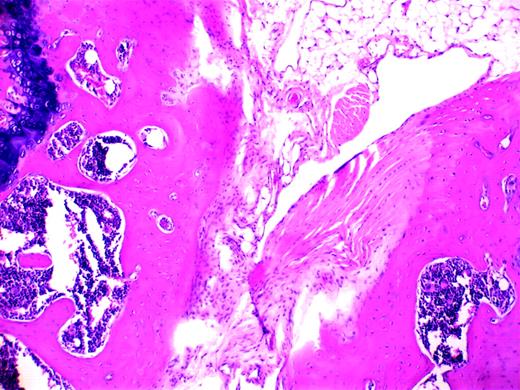 Blood-induced synovitis as a murine model of human HS. See the complete figure in the article beginning on page 2060.