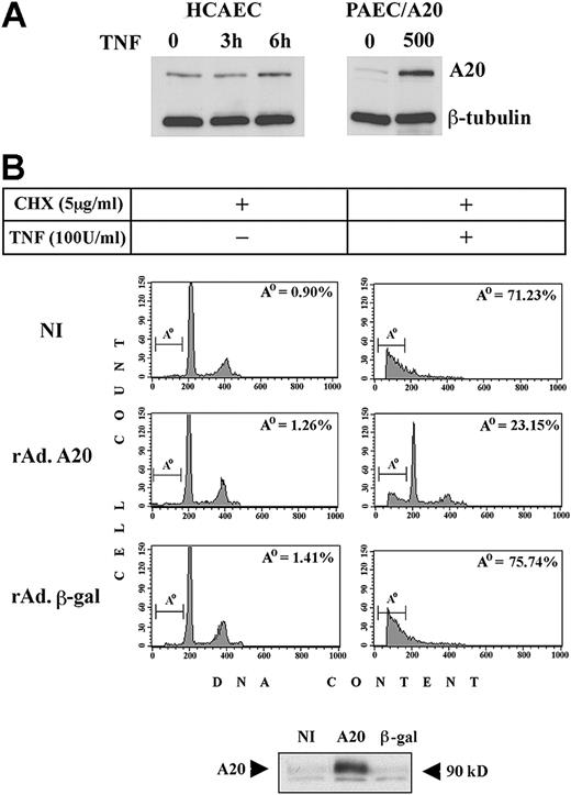 Figure 1. Effect of A20 overexpression on apoptotic fragmentation. Overexpression of A20 prevents apoptotic fragmentation of cellular DNA in CHX/TNF-treated PAECs. (A) Expression of A20 was evaluated by Western blot analysis in HCAECs before and 3 and 6 hours following treatment with TNF and compared with A20 expression in NI PAECs and rAdA20-infected PAECs at an MOI of 500. In this system, rAd-mediated expression of A20 reached 2.6- to 4.3-fold that of the physiologically induced levels. Data shown are representative of 3 experiments performed. (B) Noninfected PAECs and PAECs infected with rAdβ-gal or rAdA20 were treated with CHX (2 μg/mL) and TNF (100 U/mL), either alone or in combination, for 6 hours. Apoptosis was assessed by DNA content analysis by means of flow cytometry. The region below the G1/G0 peak, designated Ao, represents cells undergoing apoptosis with fractional DNA content (less than 2N) and is presented as a percentage of the total events collected. A20 significantly (P < .0001) protected PAECs from CHX/TNF-mediated apoptosis. Expression of the A20 transgene in each experiment was assessed by Western blot analysis of cell extracts from rAdA20-infected PAECs at an MOI of 100 (arrows). Data shown are representative of 7 independent experiments.