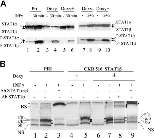 Figure 3. Inhibition of STAT1α activity in STAT1β overexpressing cells. (A) Expression and phosphorylation status of STAT1α and STAT1β. Phosphorylation status of STAT1α and STAT1β was assessed using Western blotting with an antiphosphotyrosine 701 STAT1 antibody. Cells were treated (+) (lanes 5, 6, 9, and 10) or not treated (–) (lanes 3, 4, 7, and 8) with doxycycline for 24 hours. Parental (lanes 1 and 2) and transfected (lanes 3-6) PRI cells were treated (lanes 2, 4, 6, and 10) or not treated (lanes 1, 3, 5, 7, and 9) with IFN-γ (250 U/mL) for 30 minutes (lanes 2, 4, and 6) or for 24 hours (lanes 9 and 10). Note that lanes 3 and 7 and lanes 5 and 9 represent identical samples from 2 independent experiments. (B) Analysis of the binding activity of the STAT1 isoforms to the SIE DNA probe. The binding activity to SIE was assessed using EMSA with 10 μg nuclear protein extract from parental (lanes 1-3) and transfected (lanes 4-9) cells that were either treated (+) (lanes 5, 7, 8, and 9) or not treated (–) (lane 4) with doxycycline for 24 hours and either treated (+) (lanes 2, 3, 5, 7, 8, and 9) or left untreated (–) (lanes 1 and 4) with IFN-γ (250 U/mL). Nuclear extracts were obtained from the cells shown in panel A, lanes 1 to 6. Extracts were incubated with the radiolabeled m67-SIE probe and separated on a polyacrylamide gel, and radioactivity was determined using a phosphor imaging screen. Supershifts were performed using antibodies recognizing either STAT1α and STAT1β (lanes 3 and 9) or STAT1α alone (lane 8). Supershifts show that the lower band (lane 7) comprises only STAT1β homodimers, whereas the upper bands (lanes 1, 2, and 5) comprise STAT1α homodimers and STAT1α/ STAT1β heterodimers, respectively. Note that a/a, a/b, and b/b represent the 3 different complexes binding specifically to the SIE probe. NS indicates nonspecific binding; and BS, supershifted bands (lanes 3, 8, and 9).
