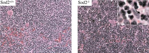 Figure 2. Sod2+/+ and Sod2–/– spleen cells stained with H&E. Erythroid hyperplasia is evident in SOD2-deficient samples. Occasional nuclear clefting is evident in Sod2–/– erythroid precursors (arrow), suggesting mild dysplasia.