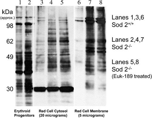 Figure 4. Protein oxidation in marrow progenitors and peripheral red cells. Protein carbonyl content in Sod2+/+ and Sod2–/– samples was compared by Oxyblot. Lane 1 (Sod2+/+) and lane 2 (Sod2–/–) compare whole-cell lysate protein from 5 × 106 Ter119+ marrow progenitor cells isolated by FACS. Lane 3 (Sod2+/+), lane 4 (Sod2–/–), and lane 5 (Sod2–/– Euk-189–treated) contain 20 μg red cell cytosolic protein, and lane 6 (Sod2+/+), lane 7 (Sod2–/–), and lane 8 (Sod2–/– Euk-189–treated) contain 5 μg membrane protein from the corresponding red cell samples.