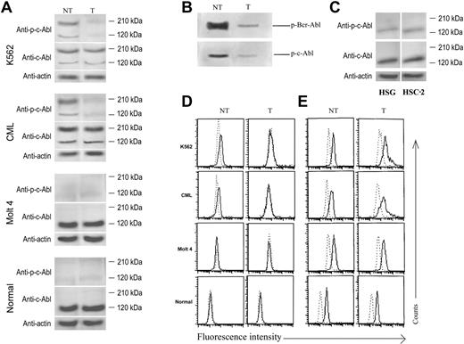 Figure 3. NaChl inhibits Bcr-Abl and c-Abl autophosphorylation in Ph+ cells. (A) Immunoblot-based determination of Abl expression and phosphorylation status. Cells were treated with NaChl (10 μg/mL) for 30 minutes, harvested, and lysed, and equivalent amount of lysates were separated by SDS-PAGE and electrotransferred. The filters were probed with anti–phospho-c-Abl (Tyr 245) (top panels) or anti–c-Abl antibody (middle panels). β-Actin was used as loading control (bottom panels). (B) In vitro kinase assay of fused (Bcr-Abl) and unfused Abl in the presence (T) or absence (NT) of NaChl (50 ng/mL, 30 minutes). (C) HSG and HSC-2 cells do not express Bcr-Abl. Cells were harvested and lysed, and equivalent amount of lysates were separated by SDS-PAGE and electrotransferred. The filters were probed with indicated antibodies. (D) Flow cytometric determination of Abl phosphorylation status. Indicated cells were left untreated (NT) or incubated with NaChl (10 μg/mL) for 30 minutes (T), fixed, permeabilized, and stained with rabbit anti–phospho-c-Abl (Tyr 245) antibody. Dotted line indicates staining with normal rabbit sera; solid line, staining with anti–phospho-c-Abl antibody. (E) Flow cytometric determination of intracellular Abl protein expression status. Cells were fixed, permeabilized, and stained with rabbit anti–c-Abl antibody. Dotted line indicates staining with normal rabbit sera; solid line, staining with anti–c-Abl antibody.