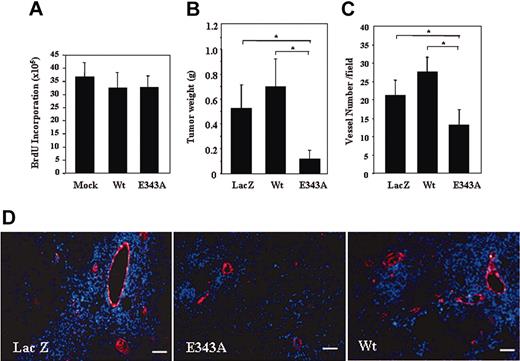 Figure 7. Mutant PILSAP inhibits tumor growth and angiogenesis in vivo. (A) B16F10 cells were transiently transfected with a mock, Wt, or E343A expression plasmid. Thereafter, B16F10 cells were stimulated with 10% FCS for 12 hours and the in vitro–incorporated BrdU were measured by a chemiluminescent BrdU ELISA (n = 6). (B) A mock, Wt, or E343A expression plasmid was incorporated into the HVJ-envelope vector and mixed with Matrigel. Matrigel was subcutaneously injected into the abdomen of C57BL/6 mice. Twenty-four hours after Matrigel injection, B16F10 cells were inoculated subcutaneously on top of the Matrigel. Fourteen days after inoculation, tumors were excised and weighed (n = 4; *P < .01). (C) The number of microvessels in the tumor tissue was counted (n = 4; *P < .01). Error bars indicate SDs. (D) Tumor sections were stained with anti-VWF antibody (red) and nuclei were counterstained with DAPI (blue). Scale bar: 100 μm. Sections were observed using fluorescence microscopy (Olympus IX71 microscope and Color View Soft Image System). Objective lens: LCPlan Fl 20×; camera: CCD Color Camera System's ColorView II; software: analySIS Docu (Soft Imaging System, Münster, Germany).