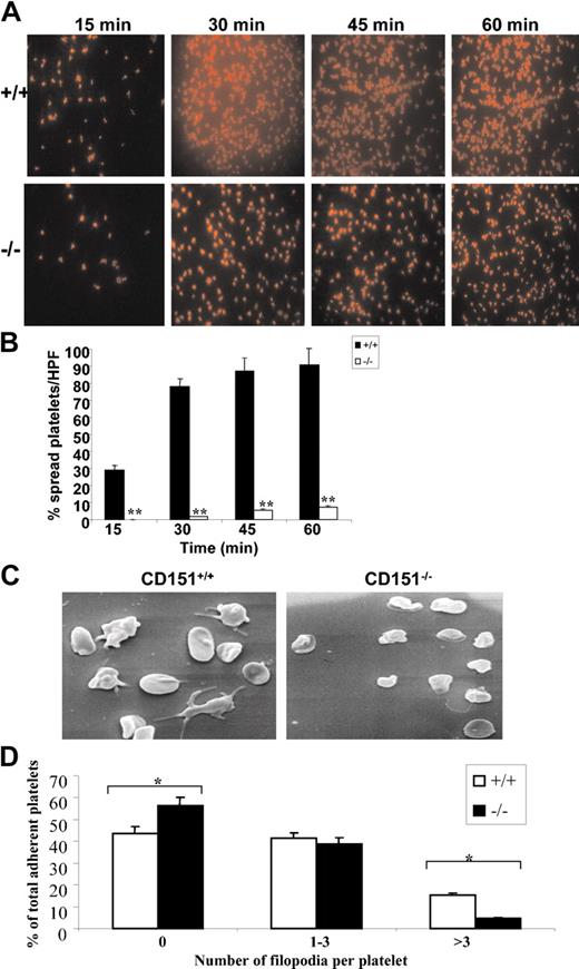 Figure 5. CD151–/– platelets have a defect in integrin-dependent cytoskeletal reorganization. (A) Washed platelets were placed on coverslips coated with fibrinogen in the presence of PGE1 for different time points at 37° C. Platelets were fixed, permeabilized, and stained for F-actin using rhodamine-conjugated phalloidin. Representative pictures of rhodamine-conjugated phalloidin-stained platelets spread on a fibrinogen surface for wild-type and CD151-deficient mice. The slides (panel A) were viewed under fluorescence microscopy using a Leitz DMRBE microscope (Leica, Hawthorn East, Victoria, Australia). Images were captured using a Leica DC200 digital camera. Magnification × 100. (B) Quantitation of platelet spreading per high-powered field was analyzed on confocal images from 8 random fields and expressed as a percentage of the total adherent platelets from CD151+/+ and CD151–/– platelets. **P < .005. (C) Washed CD151+/+ and CD151–/– platelets were allowed to adhere for 60 minutes at 37° C to a fibrinogen matrix. Adherent platelets were fixed and examined by scanning electron microscopy. Representative CD151+/+ and CD151–/– platelet scanning EM images are shown. (D) The number of filopodia per platelet were analyzed on scanning EM images from 8 random fields and expressed as a percentage of the total adherent platelets from CD151+/+ and CD151–/– platelets. *P < .005.