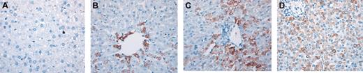 Figure 1. Adult human HSCs generate significant numbers of hepatocytes in a noninjury fetal model. (A) Control sheep liver section (nontransplanted) stained with an antibody antihuman hepatocyte (clone OCH1E5) as described in “Materials and methods.” (B-C) Liver sections obtained at 3 weeks (B) and 4 months (C) after transplantation from sheep that received transplanted human BM CD34+Lin– cells, stained with the same antibody showing a higher number of human hepatocytes in the latter (C). (D) Liver section obtained at 11 months after transplantation from sheep that received transplanted CB-derived CD34–Lin– cells, stained with antihuman hepatocyte antibody. Human hepatocytes in all sections can be identified by the dark brown coloration.