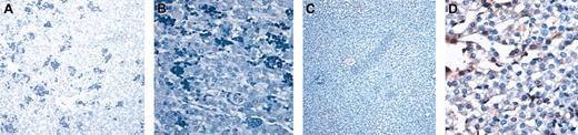 Figure 2. Human hepatocytes generated in vivo from the human hematopoietic stem cells are functional. (A-B) Low (A) and high (B) magnification of sections of livers from control (no transplantation) sheep stained with an antibody specific for human albumin. (C-D) Low (C) and high (D) magnification of a section from sheep liver given transplanted BM CD34+Lin– cells that had the highest amount of human albumin in serum. Human hepatocytes can be identified by the light brown coloration.