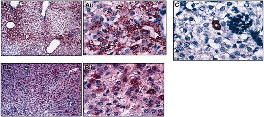 Figure 4. Different phenotypes of HSC have different characteristics regarding hepatocyte production. Low and high magnification of sections of livers from secondary sheep that received transplanted human cells from (A) CD34+Lin–CD38–, (B) CD34–CD38–Lin–, or (C) CD34+CD133+ Lin– primary recipients (high magnification Ai, Bii, C). Liver sections were stained with an antibody antihuman hepatocyte (clone OCH1E5), as described in “Materials and methods.” Animals that received transplanted CD38– populations displayed multiple hepatocytic foci throughout the hepatic parenchyma at levels similar to those generated in the primary recipients (A-B). Few hepatocytes were found in the liver sections of CD34+CD133+Lin– secondary recipients (C).