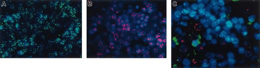 Figure 5. Human hepatocyte generation in the fetal sheep model is not caused by cell fusion. In situ hybridization of liver sections of (A) a control sheep hybridized with human pericentromeric repeat (red) and sheep pericentromeric repeat (green) probes, and (B) control human liver also hybridized with both probes. As can be seen, the probes were completely species specific. Control sheep displayed only the green signal from the sheep probe, whereas the control human liver exhibited only red fluorescence from the human probe. (C) In situ hybridization of a representative liver section of a chimeric sheep. Human hepatocytes within the sections exhibited pure red fluorescence, demonstrating that they contain only human DNA and not sheep DNA, whereas the sheep hepatocytes exhibit only green fluorescence.