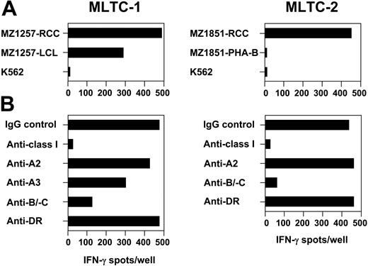 Figure 1. Generation of RCC-reactive CD8+ T cells from HLA-class Ia-matched healthy donors. In allogeneic MLTC-1 and MLTC-2, CD8+ T cells isolated from PBMCs of healthy donors 860 and 880 with a purity of more than 98% were stimulated weekly with HLA Ia–matched RCC lines MZ1257-RCC and MZ1851-RCC, respectively. HLA class Ia genotypes of donors and RCC lines are shown in Table 1. Both RCC lines were negative for HLA class II in flow cytometry. Specificity of MLTC responders was analyzed on day 25 of culture in 20-hour IFN-γ ELISPOT assays. (A) Targets were the RCC stimulator cell lines, the hematopoietic counterparts (ie, EBV-LCL or PHA-activated PBMC) derived from the same RCC patients, and NK target K562. PHA-activated PBMCs of patient MZ1257 and EBV-LCL of patient MZ1851 were not available. (B) HLA restriction of anti-RCC reactivity was determined by adding mAbs specific for total HLA class I, HLA-A2, HLA-A3, HLA-B/-C alleles, or HLA-DR. Each bar represents the mean spot number of triplicates with 10 000 MLTC responders seeded per well.
