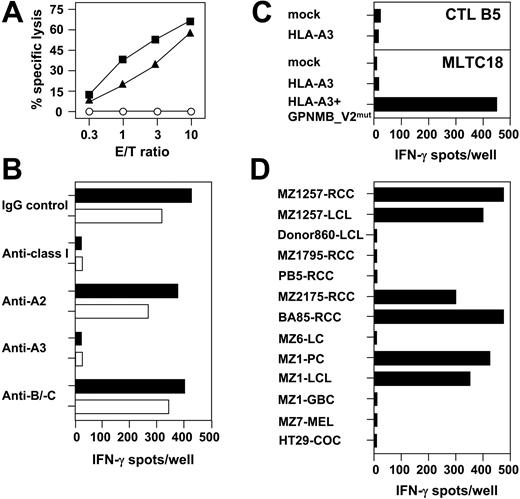 Figure 2. CTL clone B5 recognizes an HLA-A3–associated antigen expressed by renal and pancreatic carcinoma cell lines and their LCL counterparts. CTL B5 was cloned from allogeneic MLTC-1 that sensitized CD8+ T lymphocytes of healthy donor 860 against the HLA class Ia–matched RCC line MZ1257-RCC. (A) Lytic activity of CTL B5 was tested against MZ1257-RCC (▪), MZ1257-LCL (▴), and K562 (○) in a 4-hour 51Cr-release assay. Results shown are percentage of cytolysis at indicated effector-to-target (E/T) ratios. (B) Effect of different anti–HLA class I mAbs on recognition of MZ1257-RCC (▪) and MZ1257-LCL (□) by CTL B5 in 20-hour IFN-γ ELISPOT assay. (C) Full-length HLA-A*03011 cDNA cloned from MZ1257-RCC and inserted into pcDNA3.1(+) expression vector was transiently transfected in 293T cells. Transfectants were tested for recognition by CTL B5 in a 20-hour IFN-γ ELISPOT assay. In a control experiment, MZ1257-RCC–derived HLA-A*03011 cDNA was able to present a known HLA-A3–restricted peptide antigen derived from GPNMB_V2mut cDNA to antimelanoma CTL line MLTC18 (GPNMB_V2mut cDNA and MLTC18 provided by V.L. and T.W.). (D) Cross-reactivity of CTL B5 tested in 20-hour IFN-γ ELISPOT analyses against HLA-A3+ RCC, non-RCC tumor, and LCL cell lines. LCL indicates Epstein-Barr virus (EBV)–transformed B-lymphoblastoid cell line; MEL, melanoma cell line; LC, lung cancer cell line; COC, colon cancer cell line; PC, pancreatic-carcinoma cell line; and GBC, gallbladder-carcinoma cell line. Results shown are a representative part of 25 HLA-A3+ targets totally tested. All spot assays were performed with 5000 CTLs seeded per well. Each bar represents the mean spot number of triplicates.