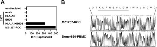 Figure 4. Human EHD2 encodes for a nonpolymorphic antigen recognized by CTL B5 in association with HLA-A*0301. (A) From MZ1257-RCC cells, cDNAs coding for full-length HLA-A*0301 or EHD2 were isolated and inserted into pcDNA3.1(+) expression vectors. They were cotransfected into antigen-negative 293T cells and were analyzed for recognition by CTL clone B5 in a 20-hour IFN-γ ELISPOT assay. Controls included 293T cells transfected with either HLA-A*0301 or EHD2 cDNAs alone, and MZ1257-RCC cells. Each bar represents the mean spot number of triplicates with 5000 CTLs seeded per well. (B) Genomic DNA was isolated from MZ1257-RCC and PBMCs of donor 860. From each sample, an EHD2 fragment containing the KLPNSVLGR epitope-coding region was amplified using specific primers. PCR products were sequenced using standard procedures.