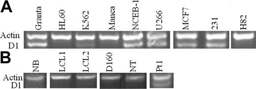 Figure 1. Cyclin D1 RT-PCR in cell lines and cells. (A) MCL cell lines NCEB-1 and Granta and MM cell line U266 expressed cyclin D1 mRNA. Breast cancer cell lines MCF7 and MDA-MB-231 (231) were also cyclin D1+. K562 stem cell/erythroleukemia cells expressed low levels of cyclin D1. HL60 and Manca cells did not express cyclin D1 mRNA. SCLC cell line H82 was also cyclin D1–. (B) Normal human B cells CD19+ (NB), EBV-immortalized human B cells (LCL1, LCL2), normal human T-cell clone (D160), and normal human T cells CD4+ (NT) were all cyclin D1–. Pt1 indicates a sample of purified B cells from peripheral blood from a patient with t(11;14) B-cell malignancy and expressed cyclin D1 mRNA. Actin was used as control.