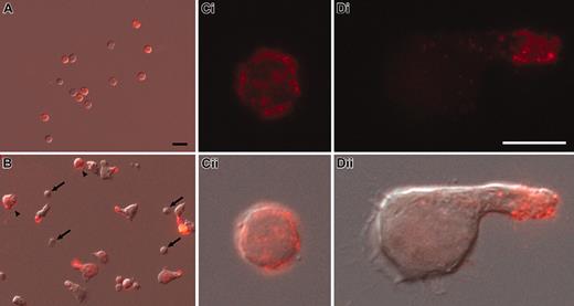 Figure 2. Cell surface redistribution of CD133 into the uropod of polarized CD34+ cells. (A-D) Human CD34+ cells, freshly isolated from umbilical cord blood (A,Ci-ii) or cultured for 2 days in the presence of early acting cytokines (B,Di-ii), were labeled with AC133 antibody (anti-CD133; red) and observed by immunofluorescence (Ci,Di). The overlays with the corresponding differential interference contrast images are shown (A-B,Cii,Dii). Note that the cultured CD133– cells remain small and round (arrows in B), whereas cultured CD133+ cells increase in size and CD133 becomes localized into the uropod of polarized cells (B,Di-ii) but remains distributed all over the surface of nonpolarized CD133+ cells (arrowheads in B). Same magnification was used in panels A and B (scale bar = 10 μm; A) or in panels Ci and Di (scale bar = 5 μm; Di), respectively.