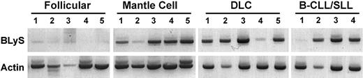Figure 3. Expression of BLyS RNA in NHL tumors. Expression of BLyS mRNA was analyzed by RT-PCR in 5 follicular, 5 mantle cell, 5 DLC, and 4 B-CLL/SLL NHL samples. Normal human monocytes were used as a positive control (data not shown).