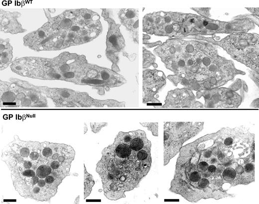 Figure 4. Transmission electron microscopy of purified platelets. Platelet-rich plasma was prepared and a platelet pellet was fixed with glutaraldehyde. After osmium staining, platelet samples were viewed by electron microscopy. Shown are representative sections from GP IbβWT and GP IbβNull platelets. A black bar in each panel represents 500 nm. Platelet areas and α-granule areas were quantified from 41 randomly selected sections and the results are presented in Table 2. Images were obtained using a Jeol JEM-1010 transmission electron microscope (Jeol, Croissysur-seine, France) at 80 kV. Quantitation of surface areas was calculated using Metamorph software (Universal Imaging, Paris, France).