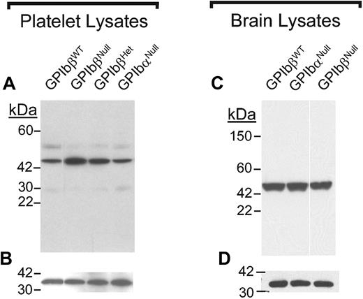 Figure 5. SEPT5 levels in platelet and brain lysates. (A) Protein concentrations in mouse platelet lysates samples were determined and similar protein amounts were loaded into a reducing 4% to 20% SDS-PAGE. After electrophoresis, the proteins were transferred to nitrocellulose and immunoblotted with an anti-SEPT5 monoclonal antibody (LJ-33). As previously shown, the predominant SEPT5 signal present in platelet lysates is approximately 45 kDa. Quantitation revealed a 2- to 3-fold increase in SEPT5 levels in platelets from GP IbβNull animals. (B) The same membrane was subsequently reacted with an anti-14-3-3ζ polyclonal antibody to document the approximate protein load for each lane using 14-3-3ζ (32 kDa) as an internal standard. (C) Equal quantities of brain lysates protein were analyzed by SDS-PAGE and immunoblotting for the septin protein, SEPT5. (D) The filter shown in panel C was reprobed for 14-3-3ζ protein and is shown for comparison.