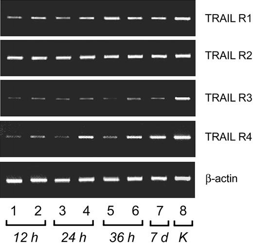 Figure 1. RT-PCR analysis of TRAIL-Receptors mRNA expression in resting and IL-2–stimulated primary human NK cells. Lanes 1, 3, and 5 show resting NK cells. Lanes 2, 4, 6, and 7 show IL-2–treated NK cells for time intervals ranging from 12 hours to 7 days. K indicates positive control (K562 cells).
