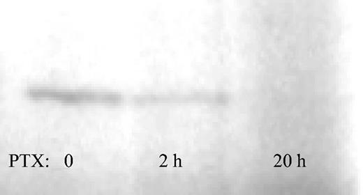 Figure 2. Kinetics of Gi protein ribosylation. Membrane-rich protein from Jurkat cells treated with PTX for 0, 2, or 20 hours was prepared as described. Nonribosylated Gi proteins in untreated cells incorporated P32 under the influence of an excess of PTX, as evidenced by a band migrating at 41 kDa (left). The presence of the 41-kDa band at 2 hours of PTX incubation evidences incomplete Gi protein ribosylation at this time point (middle). Gi protein ribosylation was complete at 20 hours (right).