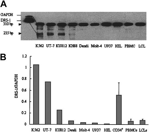 Figure 3. DRS-1 gene expression in hematopoietic cells. (A) Total RNA (20 μg) from each cell line was subjected to ribonuclease protection assay using biotin-labeled DRS-1 RNA probe and GAPDH RNA probe. The protected GAPDH probe and DRS-1 probe were visualized at 310 bp and 235 bp, respectively. (B) The same amounts of cDNA derived from each cell line or CD34+ cells were used to amplify DRS-1 or GAPDH, respectively. Relative expression levels of DRS-1 to GAPDH were determined as DRS-1/GAPDH. The levels for CD34+, PBMCs, and LCLs represent mean + SD of 3, 6, and 7 healthy individuals, respectively.