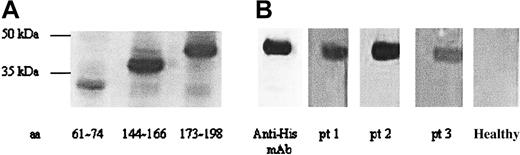 Figure 4. Mapping of antibody epitopes in DRS-1 protein. (A) Lysates of transformed E coli expressing 3 different DRS-1 fragments (aa's 61-74, aa's 144-166, aa's 173-198) were tested for reactivity to the original serum from patient 1 (pt 1). (B) Recombinant proteins derived from one epitope clone aa's 173 to 198 were purified and subjected to Western blotting using the sera of AA patients who exhibited antibodies specific to the native DRS-1 protein. Patient 2 (pt 2) and patient 3 (pt 3) represent other PNH+ AA patients who showed high titers of DRS-1 Abs.