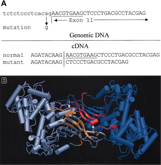 Figure 1. Point mutation in and molecular modeling of G6PD Zurich. (A) Point mutation in G6PD Zurich that leads to alternative splicing and a 9-base deletion. In the cDNA, the exon to the left of the vertical line is exon 10. Exon 11 is shown on the right side. (B) Molecular modeling of G6PD Zurich. G6PD wild type (WT) versus Zurich: an overlap of the wild type (blue and gray) and Zurich mutant (red and orange) structures reveals a change in a loop and an adjacent helix forming part of the substrate binding site. The active Lys205 (shown in CPK) is in direct proximity. The mutation affects helix of the substrate binding site in both monomers (arrows) but only minimally affects the dimer interface. The figures were created with VMD software8 (http://www.ks.uiuc.edu/Research/vmd) and rendered with Povray (http://www.povray.org).