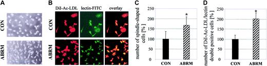 Figure 2. Effect of ABRM on attached cells. Increase in the number of spindle-shaped attached (A; light microscopy, original magnification × 100) and DiI-Ac-LDL/lectin-FITC double-positive cells (B; fluorescence microscopy, original magnification × 200) before (CON) and after treatment with ABRM. Bar graphs show cell numbers of spindle-shaped (C) or DiI-Ac-LDL/lectin double-positive cells (D) before (CON) and after treatment with ABRM, expressed as percent of untreated controls (mean ± SD, n = 3, *P < .05).