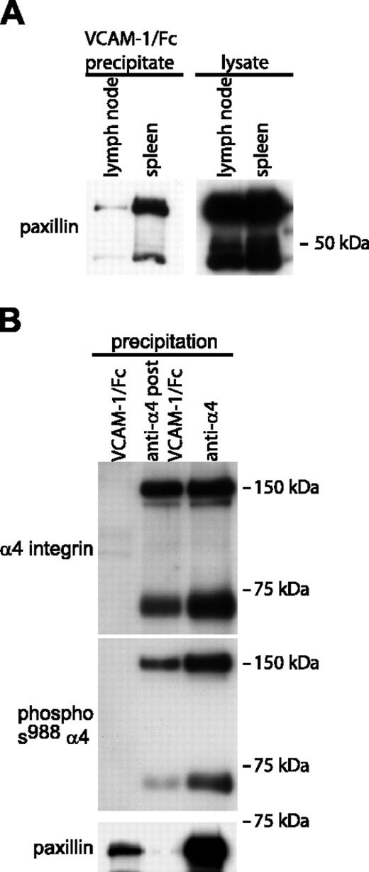 Figure 6. Paxillin associates with high-affinity α4 integrins isolated from murine spleen cells. (A) The left Western blot compares paxillin coprecipitation with high-affinity α4 integrins isolated from mouse lymph nodes and spleens (1 mg of each lysate was incubated with VCAM-1/Fc). The right blot shows paxillin expression in total cell lysates (20 μg/lane). (B) High-affinity, low-affinity, and both high- and low-affinity α4 integrins were precipitated from murine spleen cell lysates (2 mg total cell lysate per lane) as described in Figure 2. Blots were sequentially probed for phosphorylated Ser988 α4 integrin, paxillin, and α4 integrins. Representative data from 1 of 3 experiments are shown.
