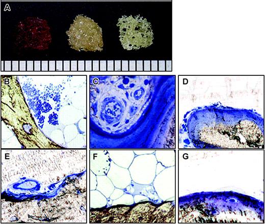 Figure 1. Human trabecular bone. (A) Trabecular bone fragment with hematopoietic cells (left), after washing (center), and after collagenase digestion (right). Scale bar = 1 mm (bottom). (B-G) Histology of trabecular bone. Each bone fragment was embedded in Epon without decalcification and stained with 1% Toluidine Blue. (B-C) Before washing. (D-F) After washing and before collagenase digestion. (G) After collagenase digestion. Original magnification: (B) × 40, (C-G) × 100.