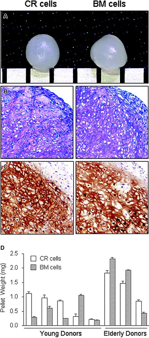 Figure 4. Chondrogenic potential of CR and BM cells. Passage 2 cells were plated at 50 cells/cm2, cultured for 14 days, and then harvested. The cells were pelleted and cultured in chondrogenesis medium for 21 days. (A) Representative macro picture. Scale bar = 1 mm. (B) Histology section stained with Toluidine Blue. Original magnification, × 100. (C) Immunohistochemistry for type II collagen. Original magnification: × 100 (B-C). (D) The cartilage pellets derived from CR cells and BM cells collected from the 5 young and 3 elderly donors were weighed and the data expressed as mean ± SD (n = 3).