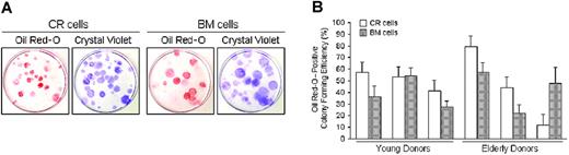 Figure 5. Adipogenic potential of CR cells and BM cells. Passage 2 cells collected from 6 donors were plated at 100 cells per 60-cm2 dish and cultured for 14 days. The cells were then incubated in adipogenic medium for an additional 21 days. (A) Adipocyte colonies stained with Oil Red-O were shown as red colonies. The same dishes were then stained with Crystal Violet and the total number of colonies was determined. Representative pictures are shown. (B) The ratio of Oil Red-O-positive colonies to the total number of colonies was calculated for each dish, and Oil Red-O-positive colony efficiency is shown for young and elderly donors. The data are expressed as mean ± SD (n = 3).