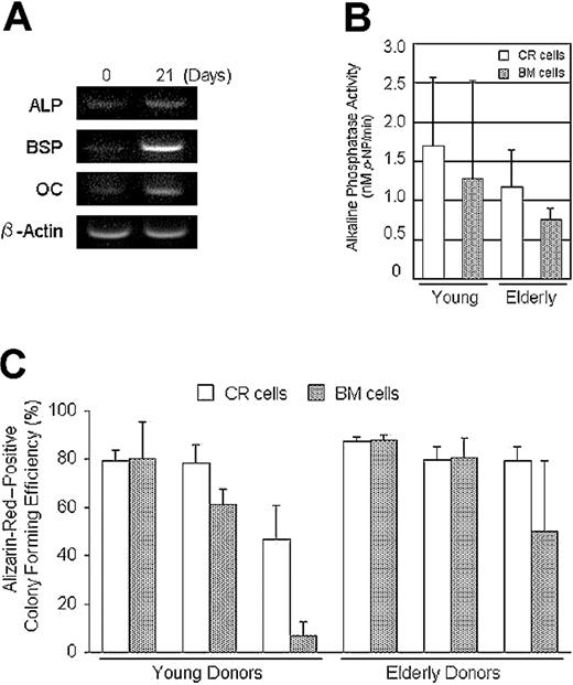 Figure 6. Osteogenic potential of CR cells and BM cells. (A) Reverse-transcription-PCR analysis. CR cells were cultured in calcification medium for 21 days. The increase of osteogenic gene expressions was confirmed. ALP indicates alkaline phosphatase; BSP, bone sialoprotein; and OC, osteocalcin. (B) Both CR cells and BM cells were cultured in calcification medium for 21 days and alkaline phosphatase activity was measured (n = 3). (C) Passage 2 cells from 6 donors were replated at 100 cells per 60-cm2 dish and cultured for 14 days. Then the cells were incubated in calcification medium for an additional 21 days. Calcified colonies were stained with Alizarin Red; then the same dishes were stained with Crystal Violet. The ratio of Alizarin Red-positive colonies to the total number of colonies was calculated for each dish and Alizarin Red-positive colony efficiency is shown for young and elderly donors. The data are expressed as mean ± SD (n = 3).