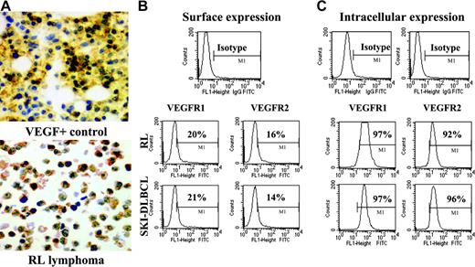 Figure 1. NHL cell lines express VEGF and VEGFR. (A) Representative results of immunohistochemistry staining for cytoplasmic VEGF in lymphoma cell cytospins. VEGF-positive control is on the top, and RL lymphoma cells are on the bottom (original magnification × 20). Results of (B) surface and (C) intracytoplasmic VEGFR expression as determined by flow cytometry on RL and SKI-DLBCL1 cells are shown.