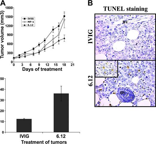 Figure 4. Inhibition of autocrine VEGFR-1 pathways reduces growth of established lymphoma xenografts in NOD/SCID mice and correlates with increased tumor apoptosis. Sublethally irradiated NOD/SCID mice were engrafted with subcutaneous RL lymphoma xenografts and were treated by intraperitoneal injection 3 times weekly with human immunoglobulin (IVIG), anti–human VEGFR-1 (6.12), or anti–murine VEGFR-2 (MF-1) antibodies. (A) Mean tumor volumes (± SE) are shown for experimental groups of 5 to 10 mice. Results were statistically significant (P < .05) for IVIG compared with 6.12 on days 2 to 19. (B) Immunohistochemical staining of xenografts following treatment demonstrated increased tumor apoptosis after VEGFR-1 (6.12) treatment compared with controls (BV = blood vessels). Inset shows TUNEL+ apoptotic lymphoma cells at 40 × magnification. (C) Quantification of the mean number of TUNEL+ cells (± SE) per low-power field (10 ×) in treated xenografts is shown (P < .05).