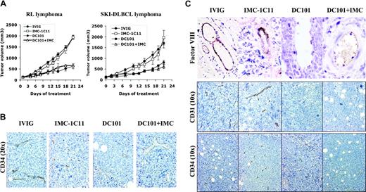 Figure 5. Inhibition of paracrine VEGFR-2 pathway reduces growth of established lymphoma xenografts in NOD/SCID mice and correlates with decreased tumor angiogenesis. (A) NOD/SCID mice engrafted with subcutaneous RL and SKI-DLBCL1 lymphoma tumors were treated with IVIG, anti–human VEGFR-2 (IMC-1C11), anti–murine VEGFR-2 (DC101), or DC101 + IMC-1C11 antibodies (n = 5-10 mice/group). Results were statistically significant (P < .05) for IVIG compared with DC101 on days 15 to 21 in both models. (B, C) Lymphoma xenografts from mice treated with IVIG, IMC-1C11, DC101, or DC101 + IMC-1C11 were stained with antibodies for CD34 (10 ×,20 ×), FVIII (von Willebrand factor 10 ×), and CD31 (10 ×). DC101 treatment decreased the number of vascular endothelial cells in vessels (von Willebrand factor and CD34 expression) and overall microvessel density (CD31+ and CD34+ vessels) compared with IVIG or IMC-1C11 treatment. Error bars indicate standard error of mean tumor volume.