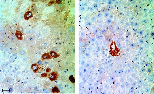 Figure 2. Immunohistochemical detection of hFIX:Ag in the liver. Immunohistochemistry was performed using rabbit anti-hFIX antibody to detect hFIX:Ag in liver biopsies taken 186 days after fetal intravascular hFIX lentivirus injection into normal MF1 mice. Strong, cytoplasmic staining was seen (left) in contrast to occasional staining in vessel lumina of liver tissue from uninjected MF1 mice (right). Scale bar is 20 μm.