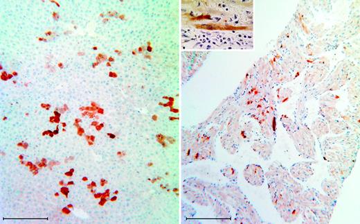 Figure 3. Immunohistochemical detection of eGFP. Rabbit anti-eGFP antibody was used to detect eGFP 30 days after intravascular injection of eGFP lentivirus into a normal MF1 mouse fetus at 16 days of gestation. Strong staining was observed mainly in hepatocytes (left) and cardiac tissue (right). Scale bar is 200 μm. A high magnification of staining in cardiac myocytes is shown in the inset.