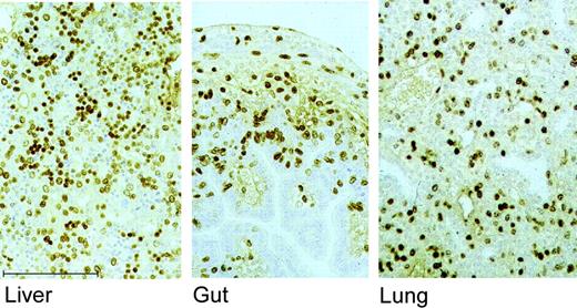 Figure 4. Assessment of cellular proliferation by BrDU immunohistochemistry. Immunohistochemistry was performed using mouse monoclonal anti-BrDU antibody to detect the presence of nuclear BrDU 24 hours after fetal intraperitoneal injection of BrDU (50 mg/kg) at 16 days of gestation. More than 50% of cells were immunopositive. Scale bar is 200 μm.