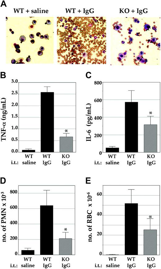 Figure 5. Attenuated IgG-IC-induced alveolar inflammation. Mice were injected intravenously with OVA, and intratracheally (i.t.) with either rabbit IgG anti-OVA or saline as control. Then, 4 hours later, the bronchoalveolar (BAL) fluids were isolated for further analysis. (A) The cellular content of the BAL fluids was examined by microscopy. (Left) Control mice injected intratracheally with saline. (Middle) Control mice injected intratracheally with IgG anti-OVA. (Right) LysMCre/Pig-aflox mice injected intratracheally with IgG anti-OVA. Concentrations of (B) TNF-α and (C) IL-6, and numbers of (D) inflammatory neutrophils (PMN) and (E) red blood cells (RBC) in the BAL fluids were determined. (B-D) Shown are mean values ± SEM of at least 3 independent experiments in control mice (WT; ▪) or LysMCre/Pig-aflox mice (KO; ▦). *Significant differences between WT and KO mice (P < .05).