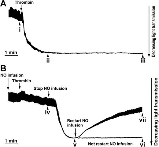 Figure 1. NO is a reversible inhibitor of the thrombin-induced shape change. Aspirin-treated and gel-filtered human platelets in the presence of CP/CPK were stimulated with thrombin (0.01 U/mL) and exposed to NO (1.1 × 10-10 mol NO/mL/min, as indicated), and platelet shape change is consistent with a decrease in light transmission (see “Materials and methods”). (A) Shape change induced by thrombin (0.01 U/mL). (B) NO infusion was started 1 minute prior to the addition of thrombin. Two minutes after the addition of thrombin, NO infusion was stopped, and 2 minutes later, infusion of NO was restarted. Aliquots were withdrawn (i-vii) for the analysis of platelet resistive-volume and platelet morphology (Figures 2 and 3). Traces are from a single experiment, representative of 6.