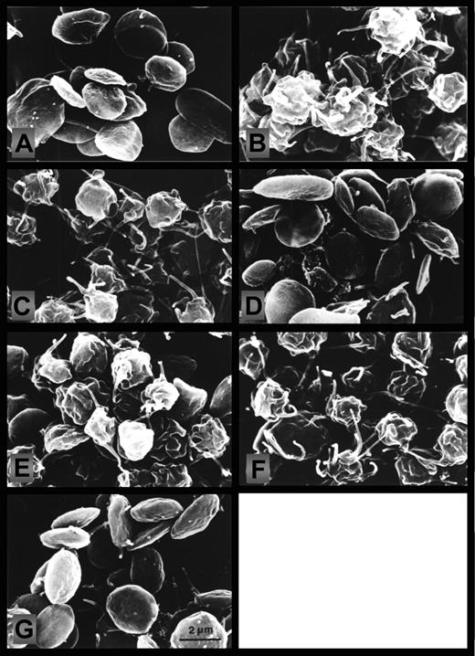 Figure 2. Effect of NO on the thrombin-induced changes in platelet morphology. Scanning electron micrographs prepared from aliquots withdrawn as depicted by letters i-vii in Figure 1 and Figure 3. (A) Control (stirred 1 minute); (B) thrombin (2 minutes); (C) thrombin (10 minutes); (D) NO (1 minute) followed by NO and thrombin together (2 minutes); (E) NO (1 minute) plus NO and thrombin together (2 minutes), then stop of NO infusion (2 minutes); (F) NO (1 minute) plus NO and thrombin together (2 minutes), then stop of NO infusion (7 minutes); (G) NO (1 minute) plus NO and thrombin together (2 minutes), then stop of NO (2 minutes); then NO reinfusion (5 minutes). Micrographs are from a single experiment, representative of 4. The micrographs were photographed on the electron microscope screen with a Leica M2 camera, exposure time ⅛ seconds, aperture 4, and a focal distance of 50 mm; screen magnification was 7000 ×.