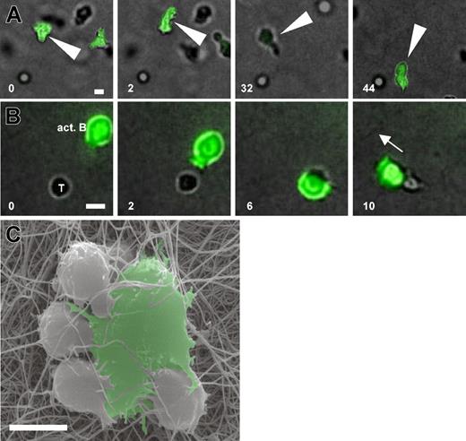 Figure 5. Activated B cells develop high cytoskeletal activity and actively engage T cells in a multifocal manner. OVA-loaded naive B cells were activated for 72 hours in the presence of DO11.10 T cells, purified, reloaded with OVA, and embedded with fresh DO11.10 T cells in 3-D collagen. (A) Activated B cells (green) display effective migration and a prominent cytoskeletal activity (Supplemental Movie 9) 30 minutes after culture set-up. (B) The formation of a contact to a DO11.10 T cell (T) involves active grabbing by B-cell membrane protrusions (white arrowheads), the movement of the B cell around the T-cell body, and its subsequent dragging by the motile B cell in its direction of movement (white arrow, and Supplemental Movie 10) 30 minutes after culture set-up. (C) SEM of DO11.10 T cells in contact with an activated B cell. The activated B cell is able to contact 4 T cells simultaneously, thereby making intense multifocal contacts to the T cells by the generation of membrane protrusions. Scale bar: 10 μm. White numbers indicate minutes of real time.