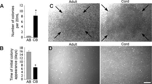 Figure 1. Isolation of endothelial progenitor cell colonies derived from adult peripheral and umbilical cord blood. (A) Number of EPC-derived ECCs isolated per 20 mL adult peripheral blood (AB) and umbilical cord blood (CB). Results represent the mean ± SEM ECCs of 18 independent experiments for adult donors and 13 independent experiments for cord blood samples. *P < .0001 by Student paired t test. (B) Time of initial EPC-derived ECC appearance after culture initiation from equivalent volumes of AB and CB blood. Results represent the mean ± SEM number of days before initial ECC appearance of 18 independent experiments for AB donors and 13 independent experiments for CB donors. *P < .0001 by Student paired t test. (C) Representative photomicrographs (50 × magnification) of EPC-derived ECCs from mononuclear cells isolated from AB (day 17) and CB (day 9). Arrows outline a representative ECC from cord and adult blood. Similar colonies were observed from 18 other adult samples and 13 other cord blood donors. (D) Representative photomicrographs (50 × magnification) of cell monolayers derived from either adult or cord blood EPC-derived ECCs. Similar cell monolayers were observed after initial passage of EPC-derived ECCs harvested from 18 other adult donors and 13 other cord blood samples. Scale bar represents 100 μm.