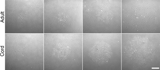 Figure 3. Representative photomicrographs of secondary colonies. Colonies formed 7 days after adult and cord blood EPC-derived endothelial cells were plated at low cell density (50 × magnification). Scale bar represents 100 μm.