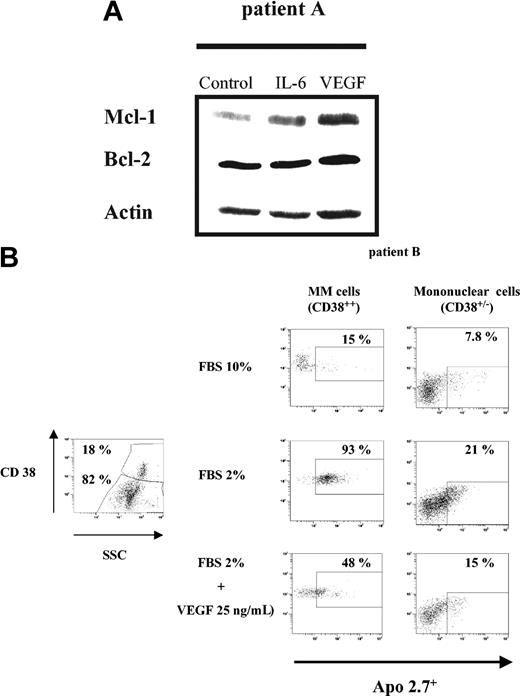 Figure 7. VEGF up-regulates Mcl-1 and protects patient MM cells from FBS starvation-induced apoptosis. (A) VEGF up-regulates Mcl-1 expression in patient MM cells. Patient MM cells were starved overnight in RPMI 1640 with 0.5% FBS, followed by culture for 6 hours in the absence or presence of either IL-6 (50 ng/mL) or VEGF (50 ng/mL). Cells lysates (30 μg per lane) were analyzed by Western blot analysis using indicated antisera. Actin was used as a loading control. (B) FBS starvation-induced apoptosis is inhibited by VEGF. Patient BM mononuclear cells were cultured for 48 hours in RPMI 1640 with 10% or 2% FBS, in the presence or absence of VEGF (25 ng/mL). The subset of MM cells (CD38++ cells; left panel) and non-MM cells (CD38+/- cells; right panel) was evaluated for apoptosis using Apo 2.7 staining. The percentage of apoptotic MM cells or non-MM cells cultured in control FBS 10% (upper lane), in FBS 2% (middle lane), and in FBS 2% supplemented with VEGF 25 ng/mL (bottom lane) is indicated.