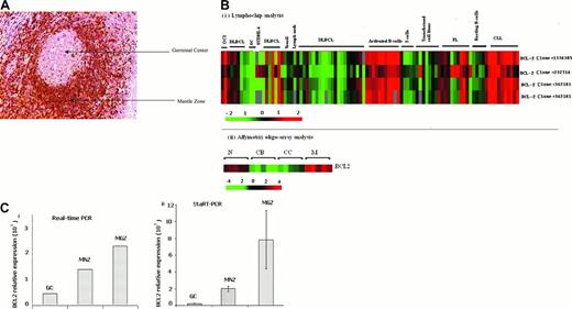 Hierarchic clustering FLT3-MU samples supervised by clinical outcome. See the complete figure in the article beginning on page 2646.