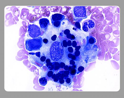 Peter Maslak, Memorial Sloan-Kettering Cancer Center