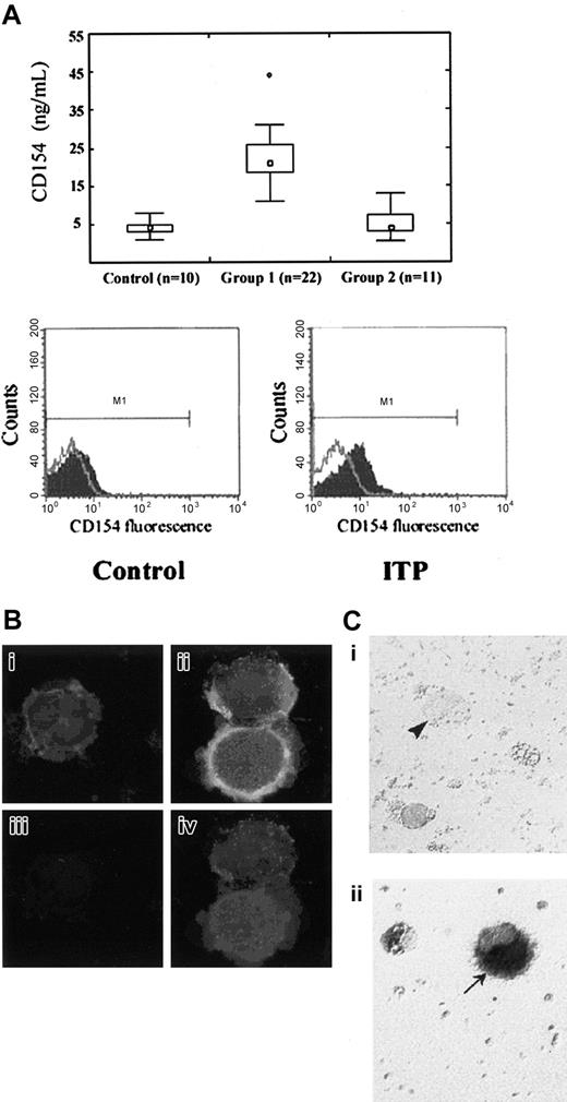 Figure 1. Platelet-associated CD154 in ITP. (A) (top panel) CD154 was quantitated by ELISA in whole platelet lysates from healthy donors (control), ITP patients (group 1), and patients with nonimmune thrombocytopenia (group 2). Median value is indicated by □. Boxes indicate 25th and 75th percentiles; error bars, 10th and 90th percentiles. ○ indicates values outside these ranges. Statistical comparison (Mann-Whitney U test) shows a significant difference between group 1 and control (P < .001) or group 2 (P < .001) platelet CD154 levels. (Bottom panel) Surface expression of CD154 on activated platelets from an ITP patient compared with a healthy donor (control). Flow cytometry profile representative of 4 experiments. (B) CD154 detection by immunofluorescence in ITP megakaryocytes. Red fluorescence corresponds to GPIIb/IIIa. Green fluorescence corresponds to CD154. Yellow fluorescence corresponds to the superposition of red and green fluorescences. (i,iii) Control megakaryocytes. (ii, iv) ITP megakaryocytes. (i, ii) Double GPIIb/IIIa plus CD154 staining. (iii, iv) CD154 staining only. (C) Detection of CD154 mRNA by in situ hybridization in ITP megakaryocytes. Highlighted (arrows) are (i) a control megakaryocyte (arrowhead) and (ii) an ITP megakaryocyte (arrow).