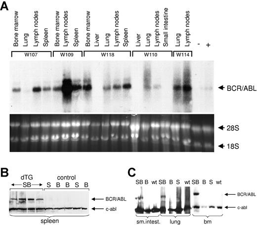 Figure 4. BCR-ABL RNA and protein are expressed in hematopoietic tissues of diseased mice. (A) Northern blot analysis of RNA isolated from organs, as indicated above the blot from 5 different SCLtTA/BCR-ABL mice (W107, W109, W118, W110, W114, as described in Table 1). RNA from the bone marrow of a SCLtTA single-transgenic (-) mouse and from the affected meninges of an MMTV tTA-BCR-ABL8 double-transgenic (+) mouse served as negative and positive controls, respectively. The lower panel shows 18S and 28S RNA as loading controls. (B) Western blot showing BCR-ABL and c-abl protein expression in the spleens of 4 SCLtTA/BCR-ABL and 5 control mice. SB, B, and S designate SCLtTA/BCR-ABL double-transgenic (dTG), BCR-ABL single-transgenic, and SCLtTA single-transgenic mice, respectively. (C) Western blot of cells from the small intestine (sm.intest.), lung, and bone marrow (bm) of SCLtTA/BCR-ABL double-transgenic (SB), BCR-ABL single-transgenic (B), SCLtTA single-transgenic (S), and wild-type (wt) mice.