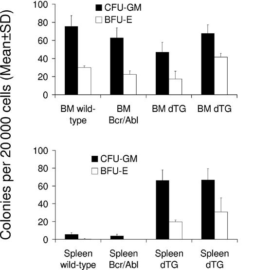 Figure 6. SCLtTA/BCR-ABL mice have increased clonogenic progenitor cells in the spleen but not in the bone marrow. Numbers of CFU-GM (▪) and BFU-E (□) (mean ± SD) were assessed per 20 000 cells extracted from the bone marrow (BM) (upper panel) or spleen (lower panel) on days 42 and 30 after induction of 2 induced double-transgenic mice (dTG) (W185 and W202, respectively) or 2 control mice (wild-type or BCR-ABL single-transgenic, as indicated). Differences of CFU-GM and BFU-E between SCLtTA/BCR-ABL and control mice were statistically significant (P < .05).