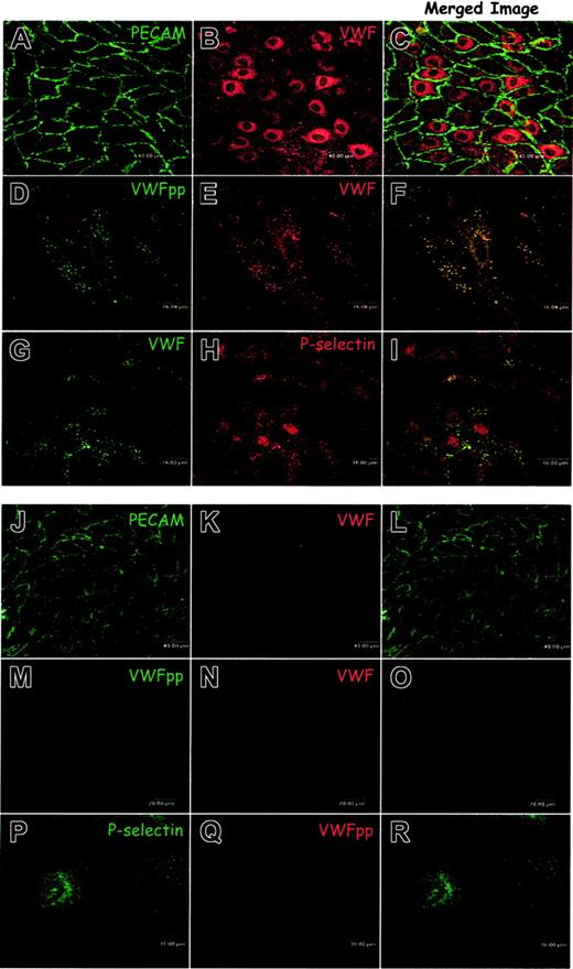 Figure 2. Aortic endothelial cells obtained from a normal dog maintain a normal Weibel-Palade body distribution of VWFpp, VWF, and P-selectin while canine VWD aortic endothelial cells neither express VWF nor contain Weibel-Palade bodies. (A-I) Endothelial cells were harvested from the aortas of normal dogs, grown on gelatin-coated slides, fixed, permeabilized, immunostained, and examined by confocal microscopy as described in “Materials and methods.” Cells immunostained with a mouse monoclonal anti-PECAM (A) and a polyclonal anti-VWF (B) demonstrated a homogeneous population of endothelial cells. Staining with a mixture of several mouse monoclonal anti-VWFpp (D) and a polyclonal anti-VWF (E) demonstrated the presence of both proteins in granules where they colocalized (F, colocalization is indicated by yellow pixels). Immunostaining of the normal endothelial cells with the mouse monoclonal anti-VWF, AVW-1 (G), and rabbit anti–P-selectin (H) revealed that VWF was colocalized with P-selectin in granules (I). The aortic endothelial cells from normal dogs maintain characteristic Weibel-Palade bodies. (J-R) Endothelial cells were harvested from the aortas of type 3 VWD dogs, cultured, immunostained, and examined by confocal microscopy. Cells were dual-labeled with mouse monoclonal anti-PECAM (J) and polyclonal anti-VWF (K). The homogeneous population of endothelial cells was VWF-negative. Neither VWF nor VWFpp could be detected in these cells by immunostaining with a mix of several mouse monoclonal anti-VWFpp antibodies (M) and polyclonal anti-VWF (N). Cells were also labeled with a rabbit anti–P-selectin antibody (P) in addition to the canine-specific monoclonal VWFpp antibody (Q). Staining for P-selectin was faint and diffuse with many small granules (P). No apparent Weibel-Palade bodies were detected in the canine VWD aortic endothelial cells.